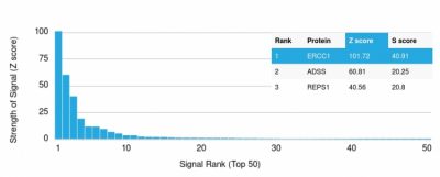 ERCC1 / RAD10 Monoclonal Mouse Antibody (ERCC1/2318)