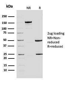 ERCC1 / RAD10 Monoclonal Mouse Antibody (ERCC1/2683)