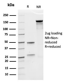 Erythropoietin Recombinant Monoclonal Mouse Antibody (rEPO/1367)