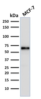 Estrogen Receptor, Alpha Monoclonal Mouse Antibody (ER506)