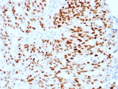 Estrogen Receptor, Alpha Monoclonal Mouse Antibody (ESR1/1904)