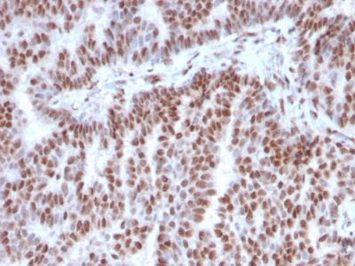 Estrogen Receptor, Alpha Monoclonal Mouse Antibody (ESR1/3342)