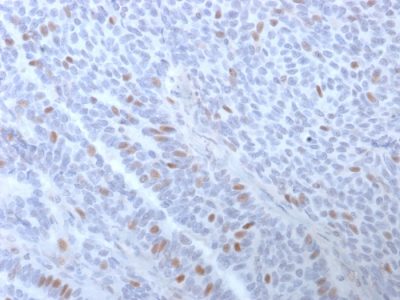 Estrogen Receptor, Alpha Monoclonal Mouse Antibody (ESR1/3373)
