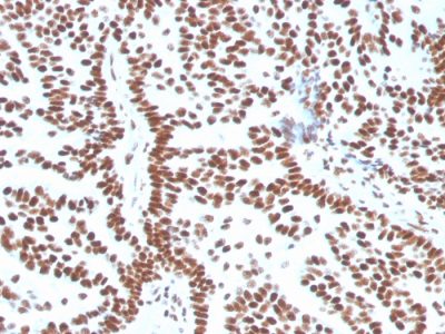 Estrogen Receptor, Alpha Monoclonal Mouse Antibody (ESR1/3556)