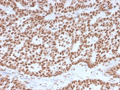 Estrogen Receptor, Alpha Monoclonal Mouse Antibody (ESR1/3557)
