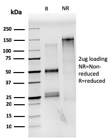 Estrogen Receptor, Alpha Monoclonal Mouse Antibody (ESR1/3559)