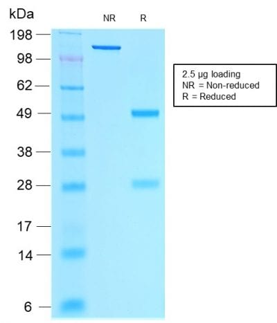 Estrogen Receptor, Alpha Recombinant Monoclonal Mouse Antibody (rESR1/1935)