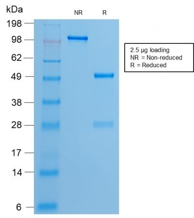 Estrogen Receptor, Alpha Recombinant Monoclonal Rabbit Antibody (ESR1/2299R)