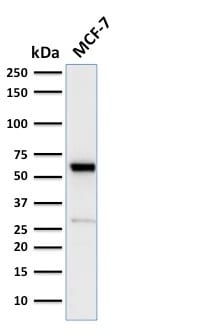 Estrogen Receptor, Alpha Recombinant Monoclonal Rabbit Antibody (ESR1/2299R)