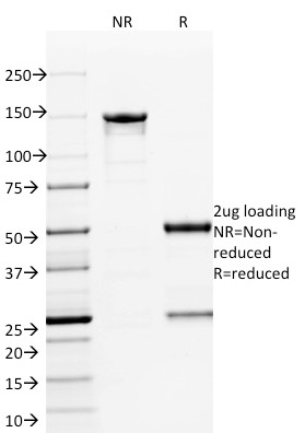 ETS1 Monoclonal Mouse Antibody (ETS1/1801)
