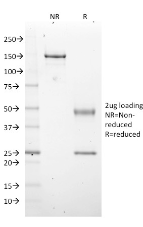 EZH2 / KMT6 Monoclonal Mouse Antibody (EZH2/2536)