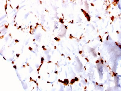 FABP5 Monoclonal Mouse Antibody (CPTC-FABP5-3)