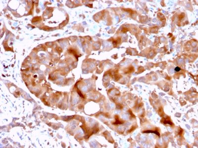 FABP5 Monoclonal Mouse Antibody (FABP5/3750)