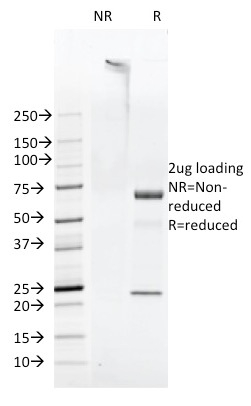FAT1 Monoclonal Mouse Antibody (FAT1-3D7/1)