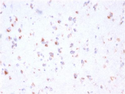 FCGRT / FcRn Monoclonal Mouse Antibody (FCGRT/2932)