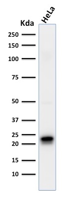 Ferritin, Heavy Chain Monoclonal Mouse Antibody (FTH/2081)