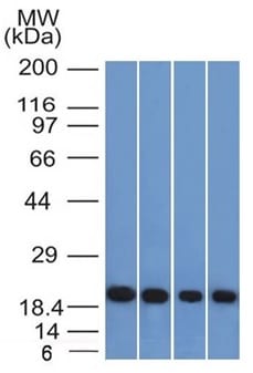 Ferritin, Light Chain Monoclonal Mouse Antibody (FTL/1386)