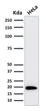 Ferritin, Light Chain Monoclonal Mouse Antibody (FTL/1386)