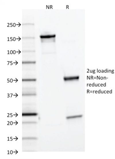 Ferritin, Light Chain Monoclonal Mouse Antibody (FTL/1386)