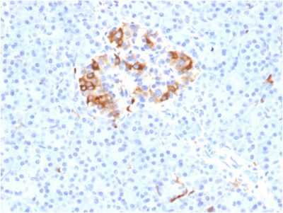 Ferritin, Light Chain Monoclonal Mouse Antibody (FTL/1387)