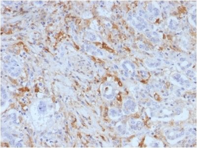 Ferritin, Light Chain Monoclonal Mouse Antibody (FTL/1388)