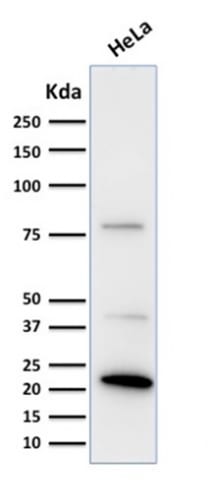 Ferritin, Light Chain Monoclonal Mouse Antibody (FTL/1388)