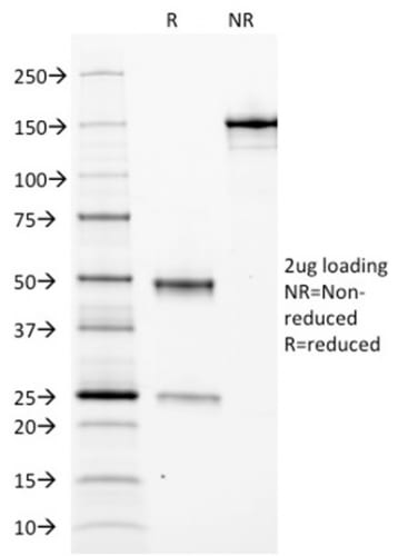 Ferritin, Light Chain Monoclonal Mouse Antibody (FTL/1388)