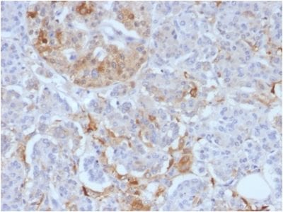 Ferritin, Light Chain Monoclonal Mouse Antibody (FTL/1388)