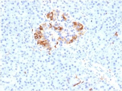Ferritin, Light Chain Monoclonal Mouse Antibody (FTL/1389)