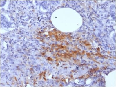 Ferritin, Light Chain Monoclonal Mouse Antibody (FTL/1389)