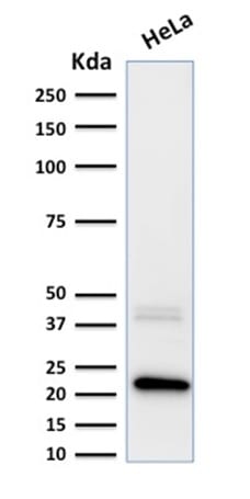 Ferritin, Light Chain Monoclonal Mouse Antibody (FTL/1389)