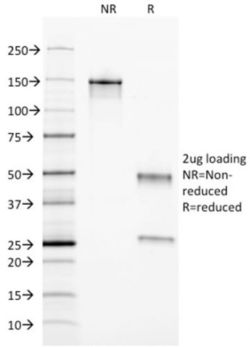Ferritin, Light Chain Monoclonal Mouse Antibody (FTL/1389)