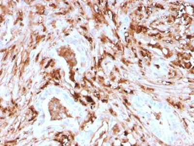 Ferritin, Light Chain Recombinant Monoclonal Mouse Antibody (rFTL/1388)