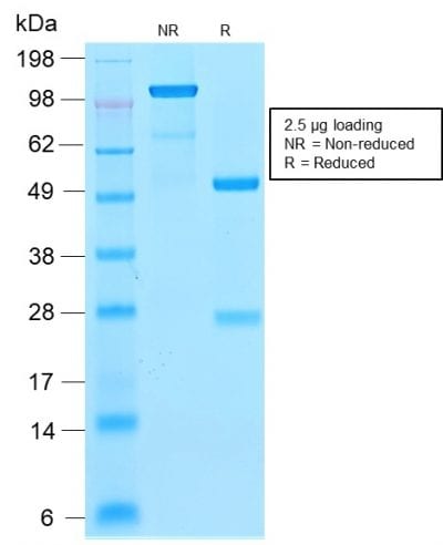 Ferritin, Light Chain Recombinant Monoclonal Rabbit Antibody (FTL/2338R)