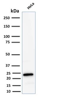 Ferritin, Light Chain Recombinant Monoclonal Rabbit Antibody (FTL/2338R)