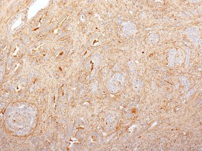 Fibronectin Monoclonal Mouse Antibody (2755-8)