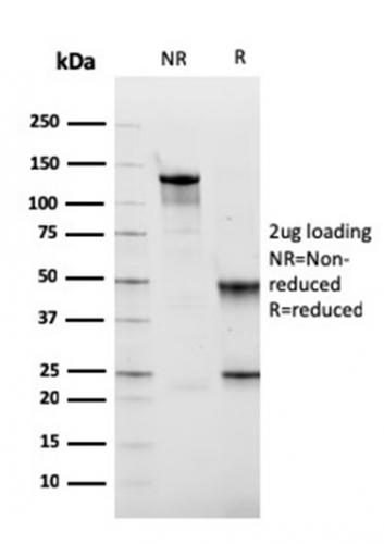 Fibronectin Monoclonal Mouse Antibody (FN1/2949)
