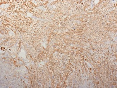 Fibronectin Monoclonal Mouse Antibody (HFN7.1)