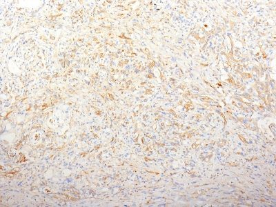 Fibronectin Monoclonal Mouse Antibody (TV-1)