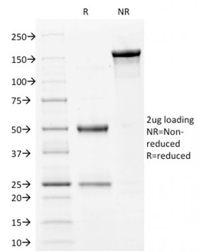 Filaggrin Monoclonal Mouse Antibody (FLG/1561)
