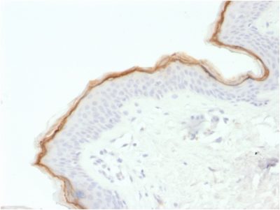 Filaggrin Monoclonal Mouse Antibody (FLG/1563)
