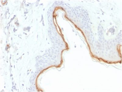 Filaggrin Monoclonal Mouse Antibody (FLG/1945)