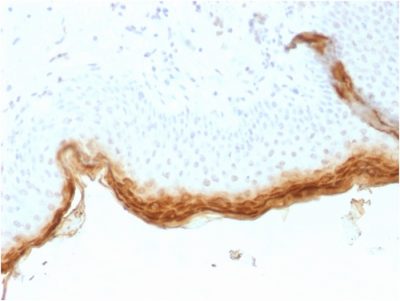 Filaggrin Recombinant Monoclonal Mouse Antibody (rFLG/1561)