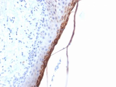 Filaggrin Recombinant Monoclonal Rabbit Antibody (FLG/1957R)