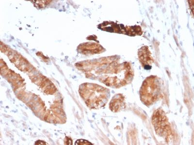 Flt3 / CD135 Monoclonal Mouse Antibody (FLT3/2458)