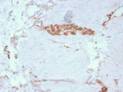 Fodrin / Alpha Spectrin II / NEAS Monoclonal Mouse Antibody (SPTAN1/3351)