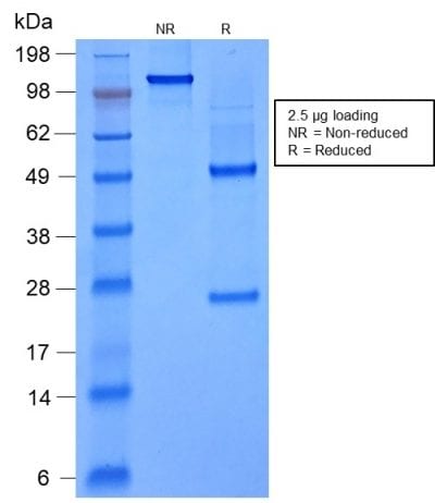 FOXA1 / HNF3A Recombinant Monoclonal Mouse Antibody (rFOXA1/1515)