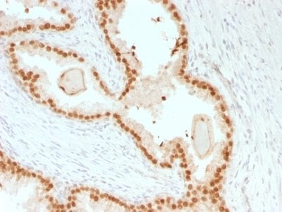 FOXA1 / HNF3A Recombinant Monoclonal Mouse Antibody (rFOXA1/1515)