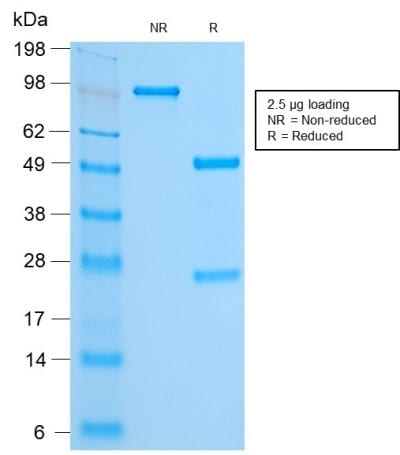 FOXA1 / HNF3A Recombinant Monoclonal Rabbit Antibody (FOXA1/2230R)