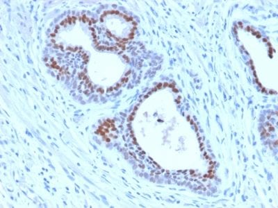 FOXA1 / HNF3A Recombinant Monoclonal Rabbit Antibody (FOXA1/2230R)